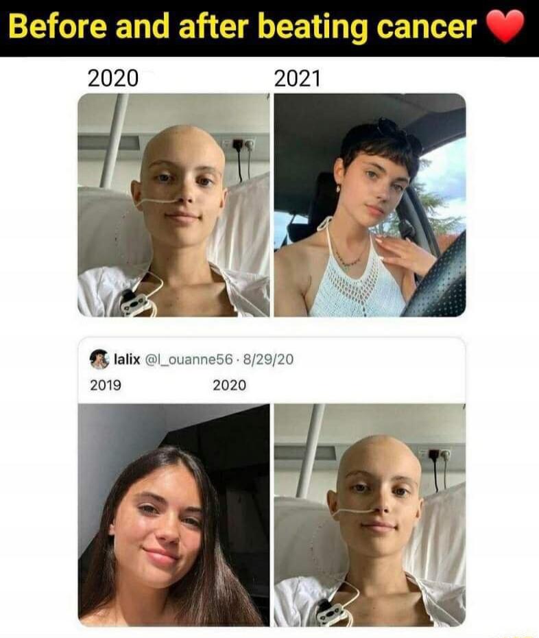 Before and after beating cancer ❤️ 2020 2021 lalix @L_ouvanne56 · 8/29/20 2019 2020