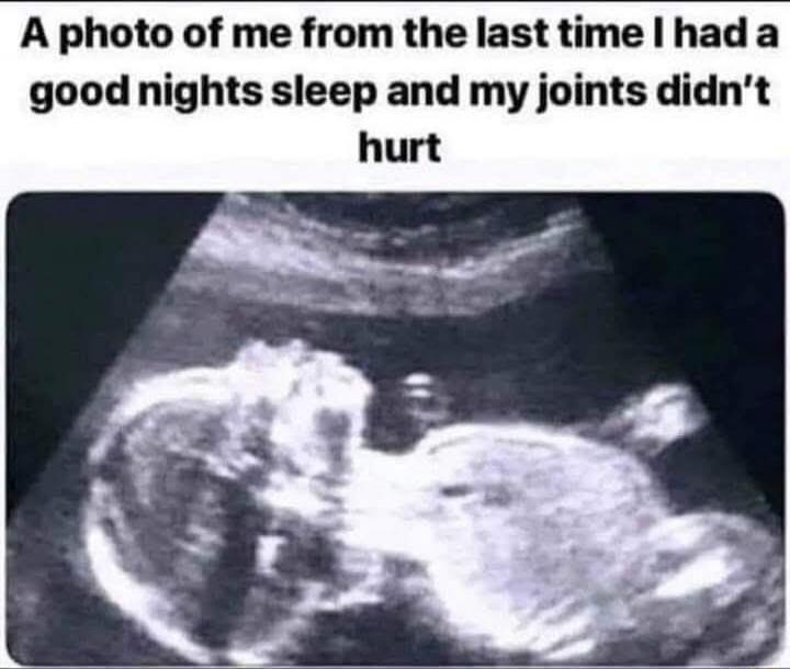 A photo of me from the last time I had a good nights sleep and my joints didn't hurt