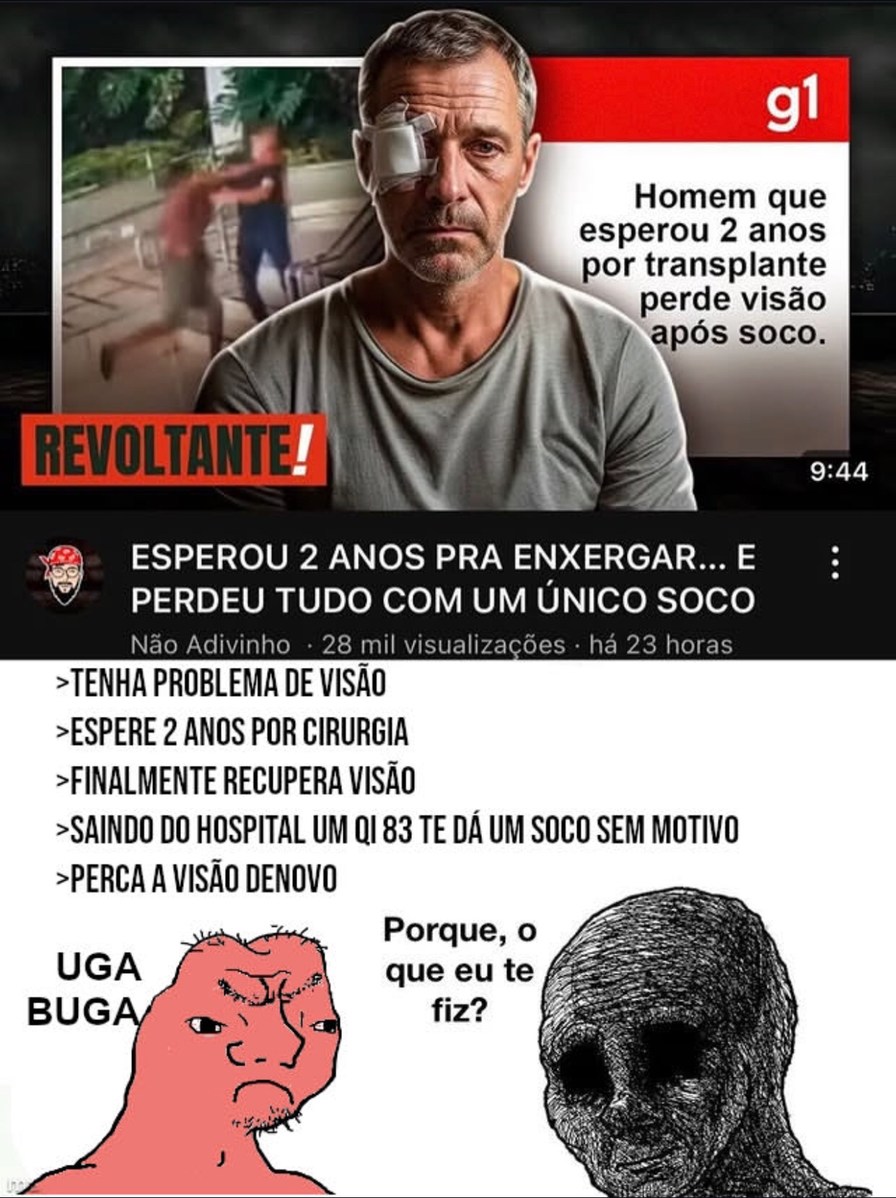 Homem que esperou 2 anos por transplante de visão perde visão após soco. REVOLTANTE! ESPEROU 2 ANOS PRA ENXERGAR... E PERDEU TUDO COM UM ÚNICO SOCO. Não Adivinha • 28 mil visualizações • há 23 horas TENHA PROBLEMA DE VISÃO ESPERE 2 ANOS POR CIRURGIA FINALMENTE RECUPERA VISÃO SAINDO DO HOSPITAL UM Q8 TE DÁ UM SOCO SEM MOTIVO PERCA A VISÃO DE NOVO