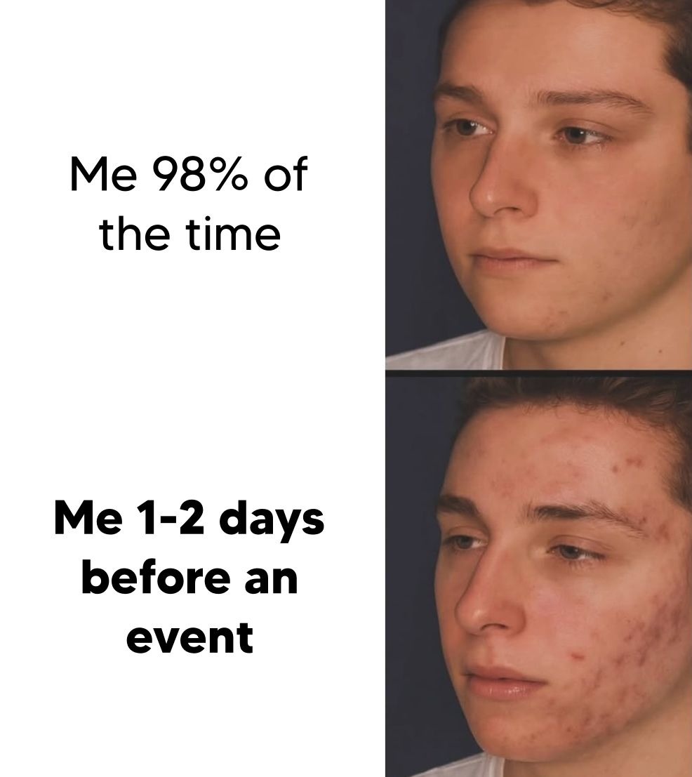 Me 98% of the time
Me 1-2 days before an event