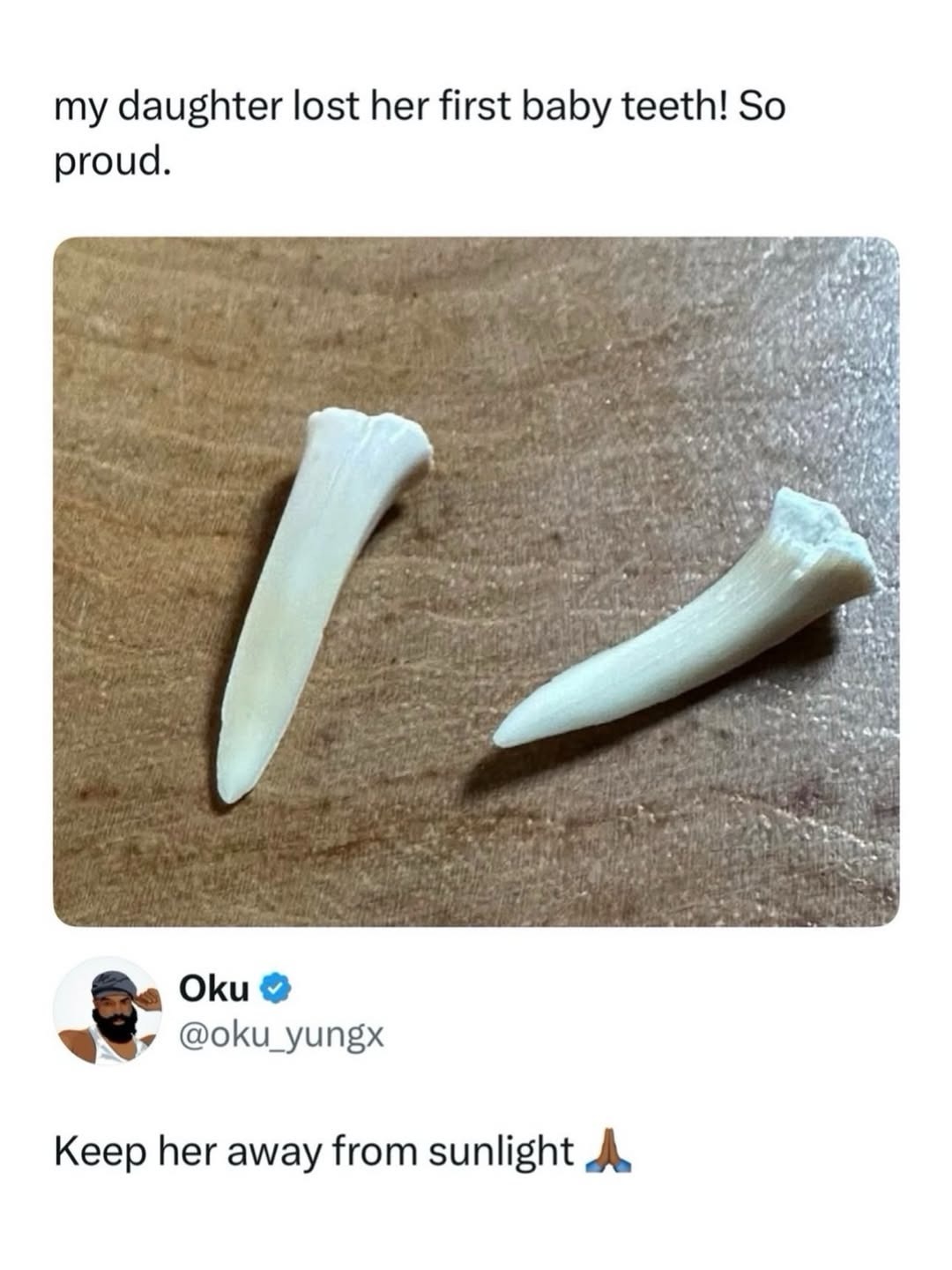 my daughter lost her first baby teeth! So proud. Keep her away from sunlight 🙏