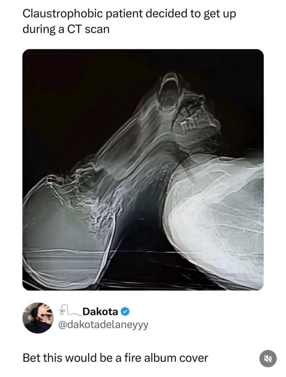 Claustrophobic patient decided to get up during a CT scan

Dakota @dakotadelaneyyy: Bet this would be a fire album cover