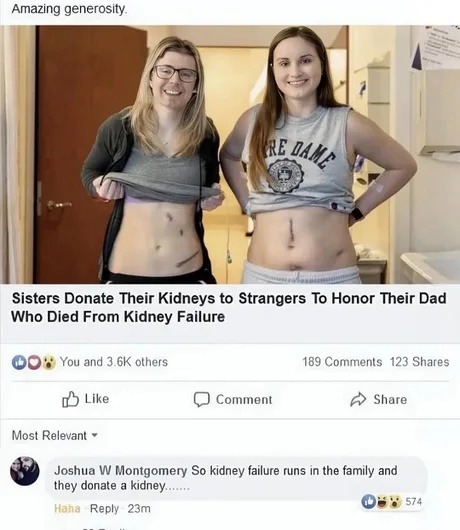 Amazing generosity. Sisters Donate Their Kidneys to Strangers To Honor Their Dad Who Died From Kidney Failure