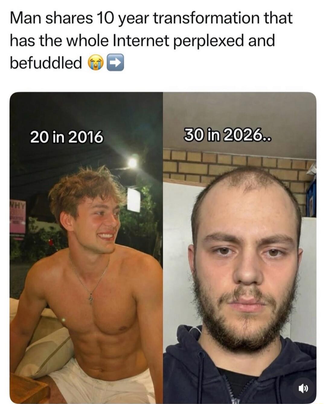 Man shares 10 year transformation that has the whole Internet perplexed and befuddled 😢➡️

20 in 2016
30 in 2026..