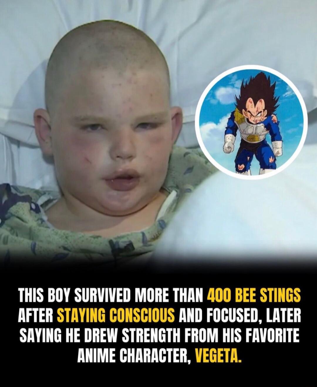 THIS BOY SURVIVED MORE THAN 400 BEE STINGS AFTER STAYING CONSCIOUS AND FOCUSED, LATER SAYING HE DREW STRENGTH FROM HIS FAVORITE ANIME CHARACTER, VEGETA.
