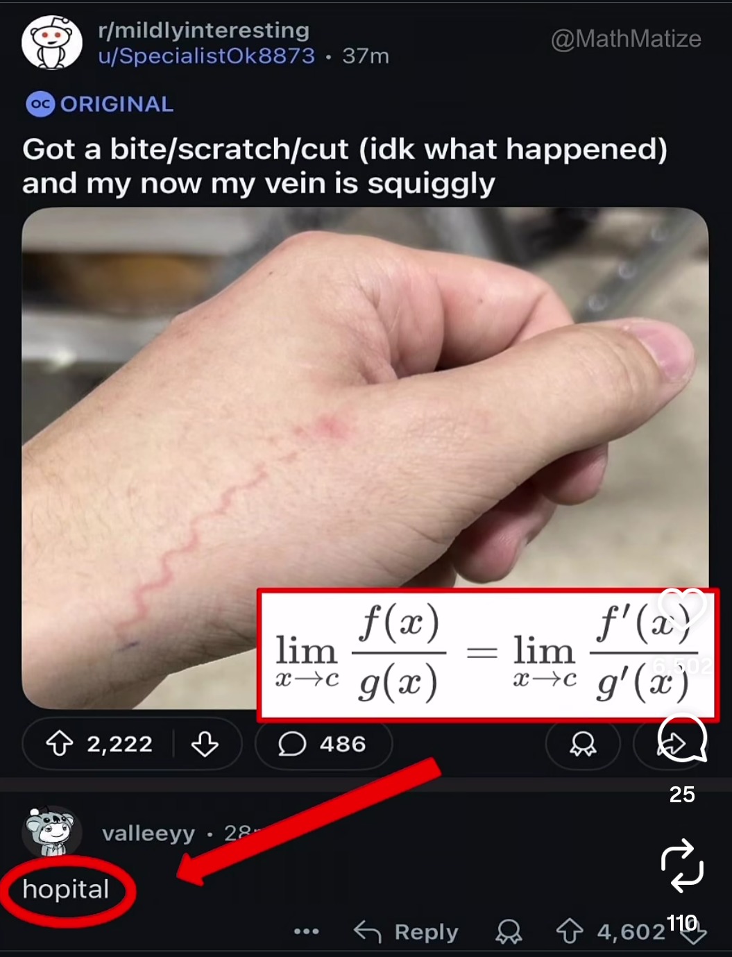 Me dio un mordisco/rasguño/corte (no sé qué pasó) y ahora mi vena está tortuosa. 

 lim_{x→c} f(x)/g(x) = lim_{x→c} f'(x)/g'(x) 