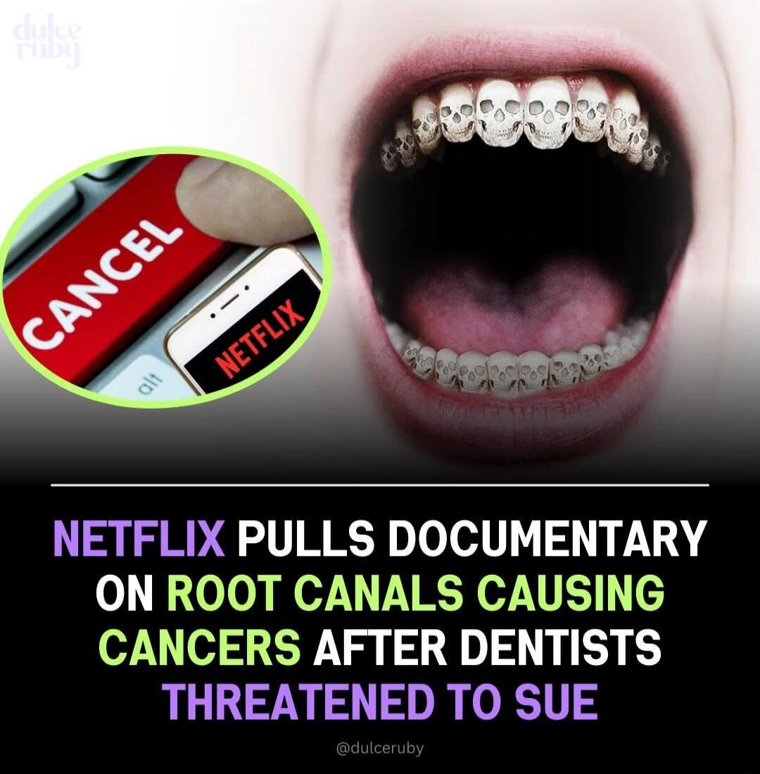 NETFLIX PULLS DOCUMENTARY ON ROOT CANALS CAUSING CANCERS AFTER DENTISTS THREATENED TO SUE