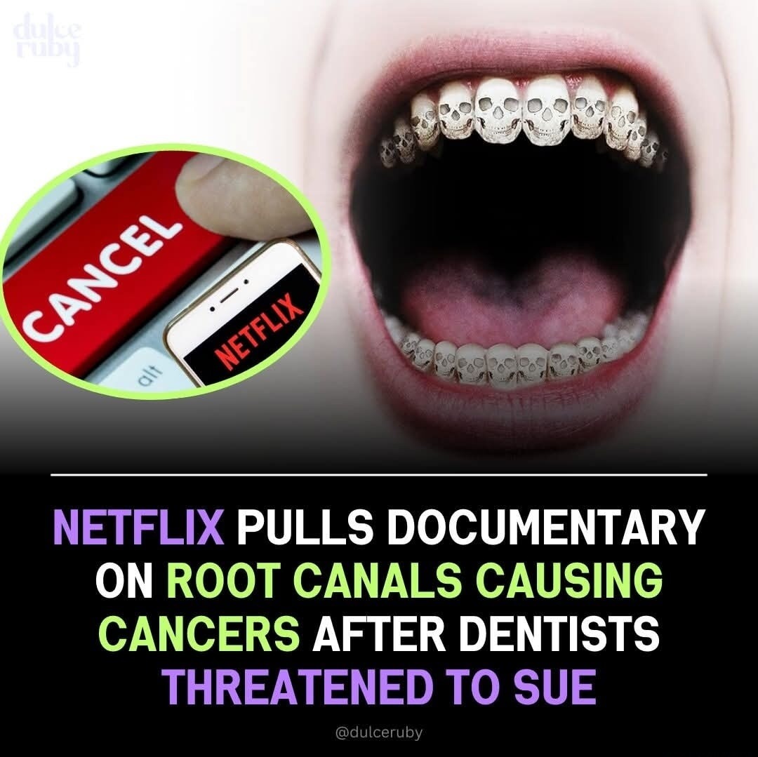 NETFLIX PULLS DOCUMENTARY ON ROOT CANALS CAUSING CANCERS AFTER DENTISTS THREATENED TO SUE