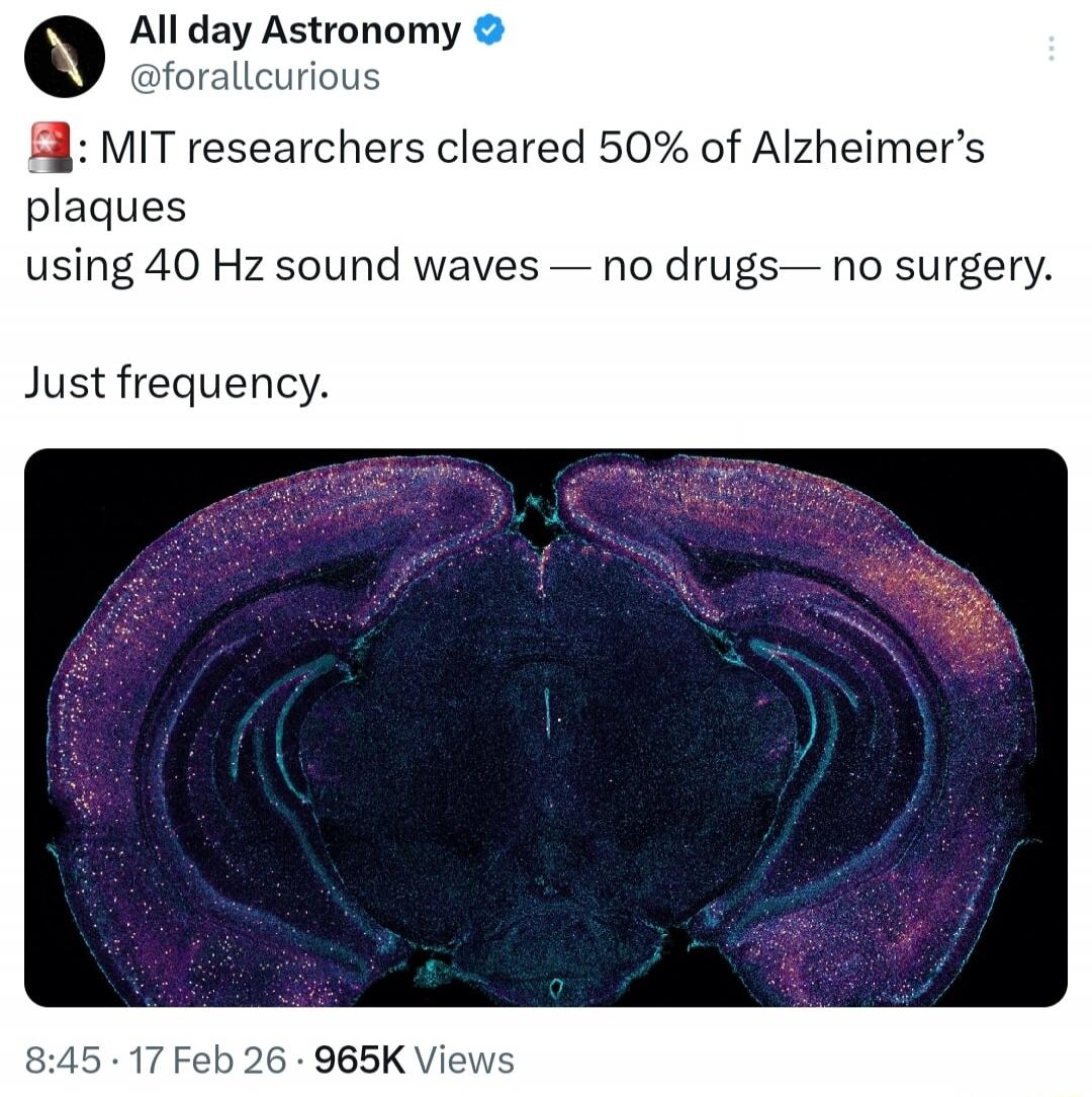 MIT researchers cleared 50% of Alzheimer's plaques using 40 Hz sound waves — no drugs — no surgery. Just frequency.