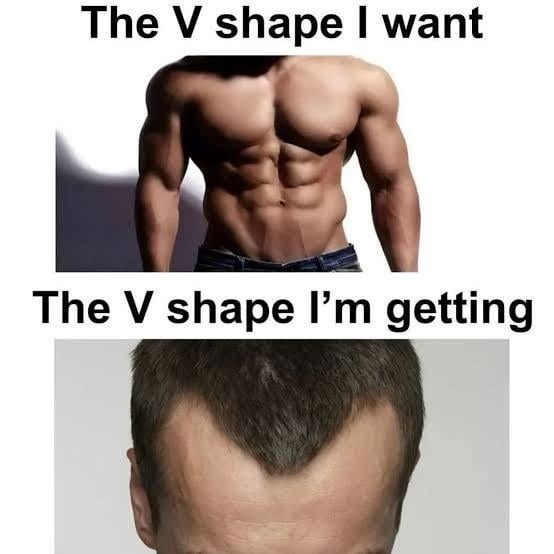 The V shape I want
The V shape I’m getting