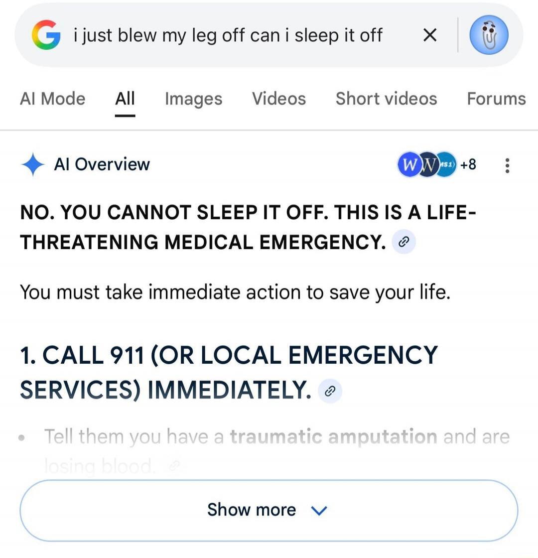i just blew my leg off can i sleep it off
NO. YOU CANNOT SLEEP IT OFF. THIS IS A LIFE-THREATENING MEDICAL EMERGENCY.
You must take immediate action to save your life.
1. CALL 911 (OR LOCAL EMERGENCY SERVICES) IMMEDIATELY.
Tell them you have a traumatic amputation and are losing blood.