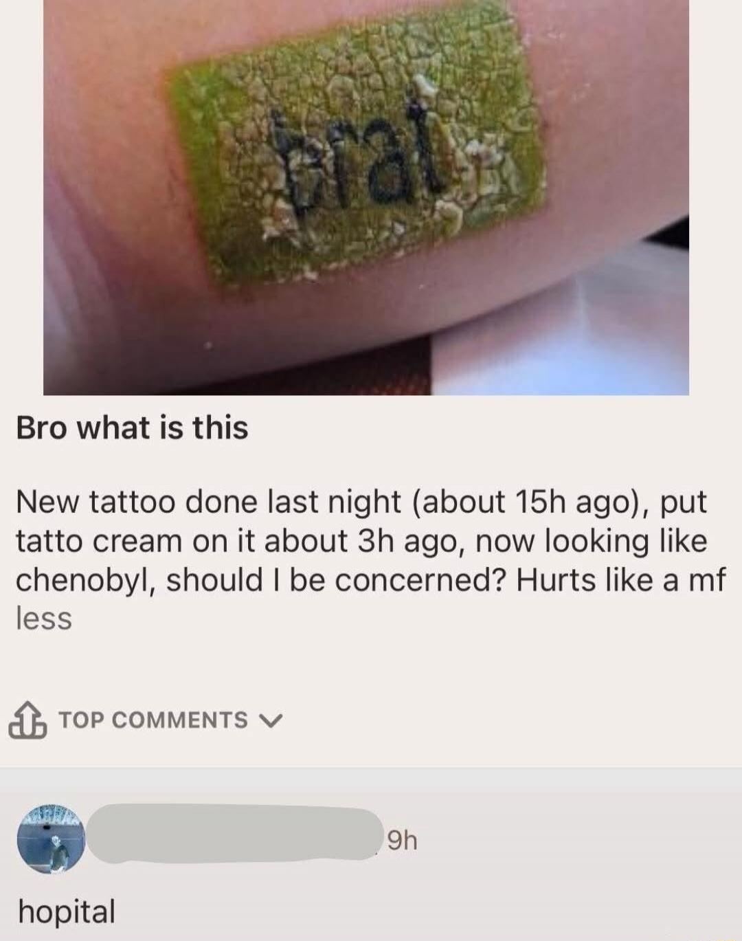 Bro what is this

New tattoo done last night (about 15h ago), put tattoo cream on it about 3h ago, now looking like chenobyl, should I be concerned? Hurts like a mf less