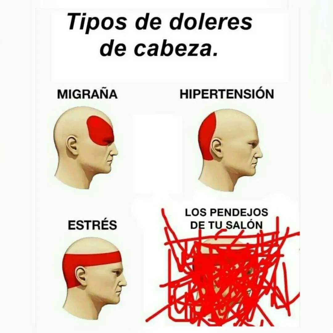 Tipos de dolores de cabeza. Migraña. Hipertensión. Estrés. Los pendejos de tu salón.