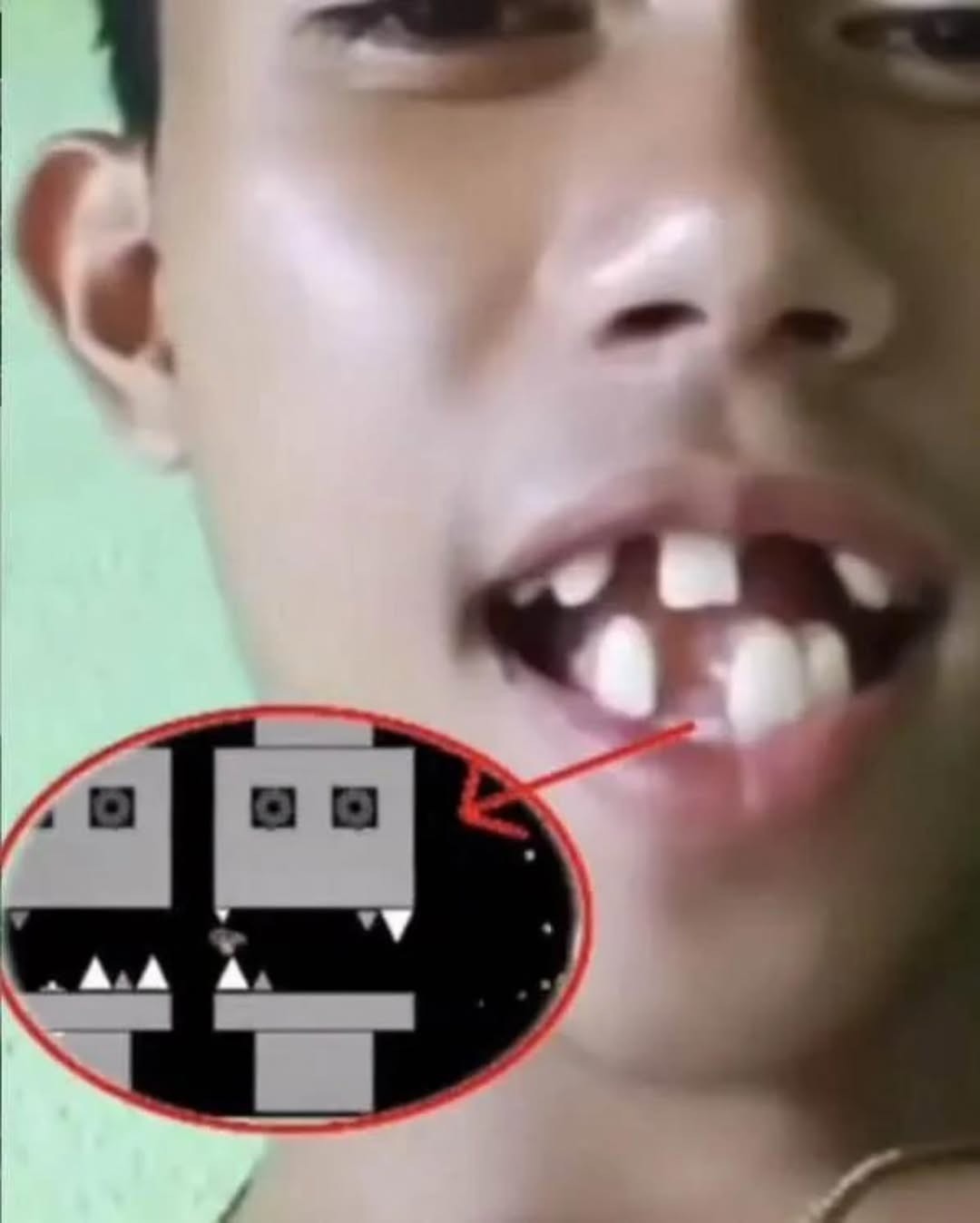 El niño muestra sus dientes frontales rotos y un círculo rojo apunta a una imagen del juego Geometry Dash.
