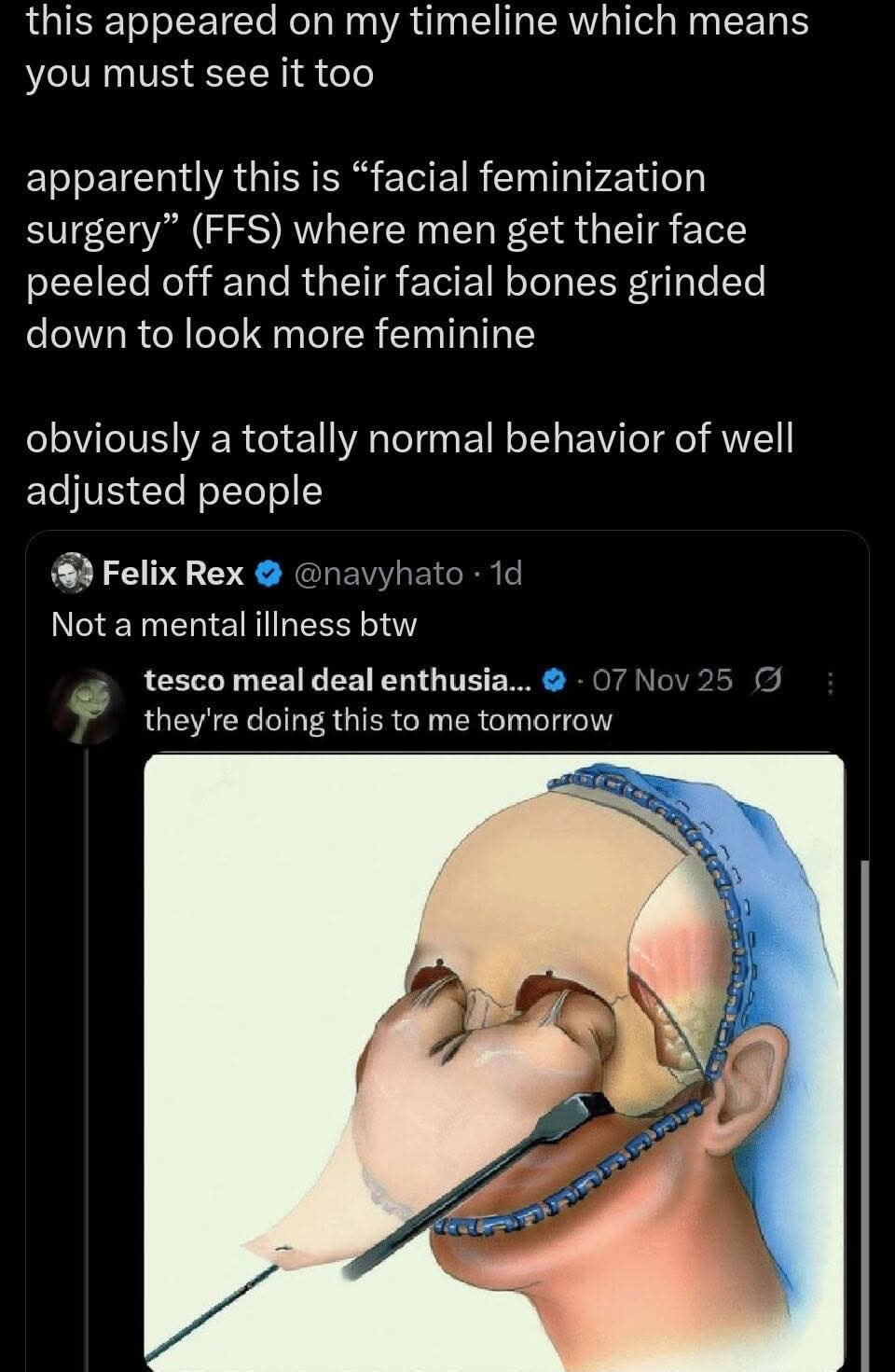 this appeared on my timeline which means you must see it too apparently this is 