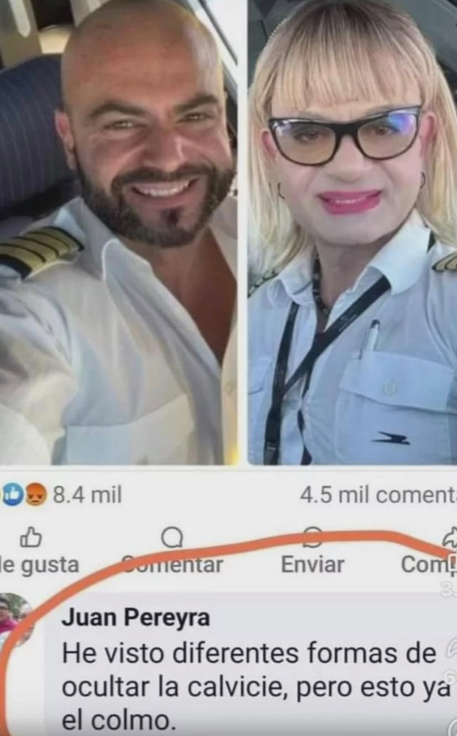 He visto diferentes formas de ocultar la calvicie, pero esto ya el colmo.