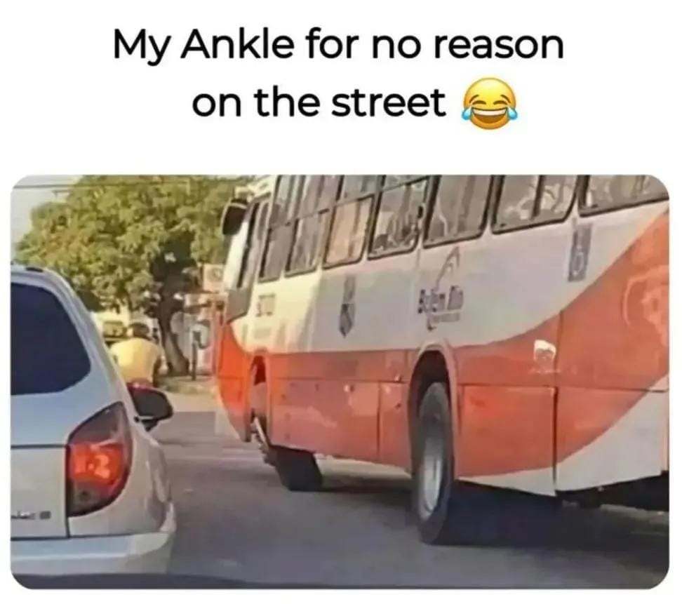 My Ankle for no reason on the street 😂