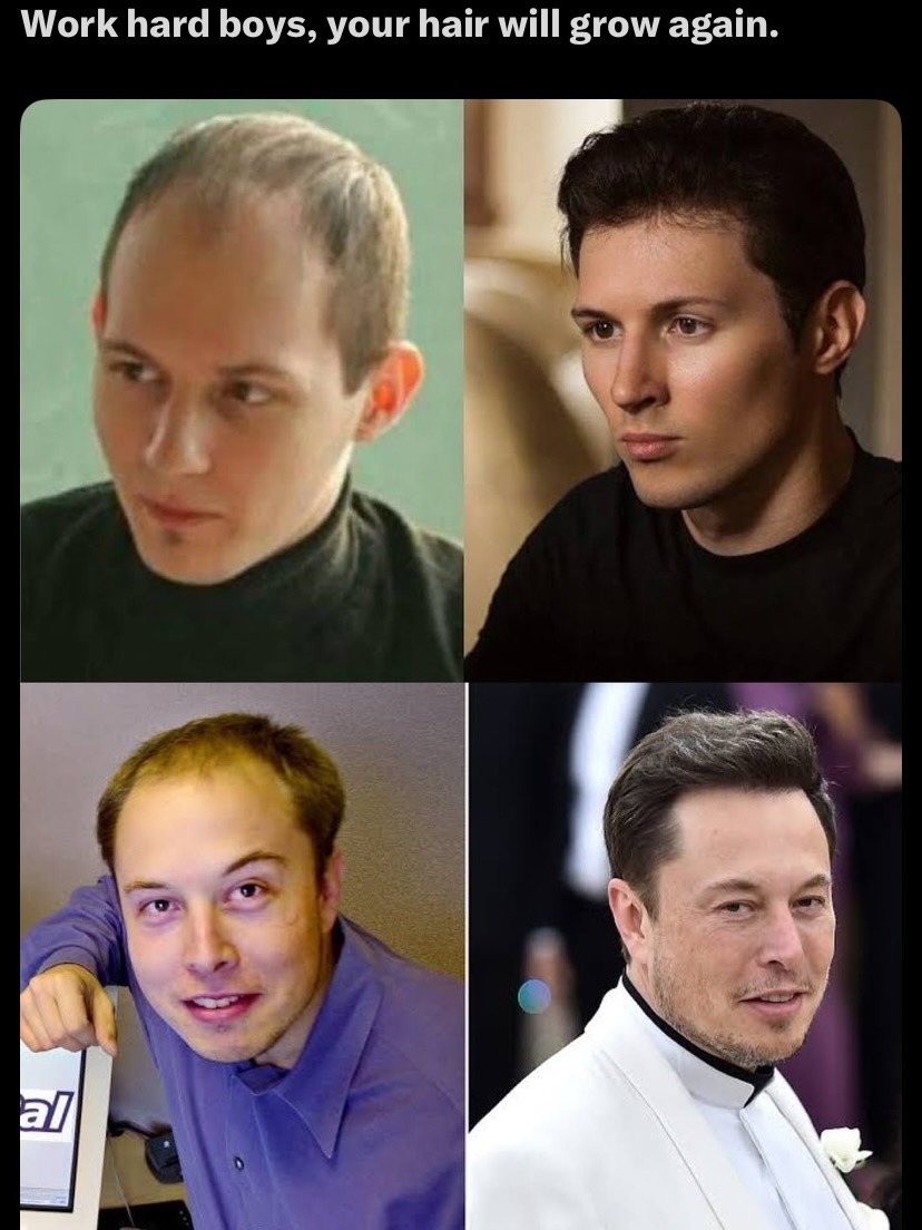 Work hard boys, your hair will grow again.