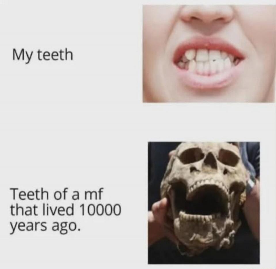 My teeth
Teeth of a mf that lived 10000 years ago.