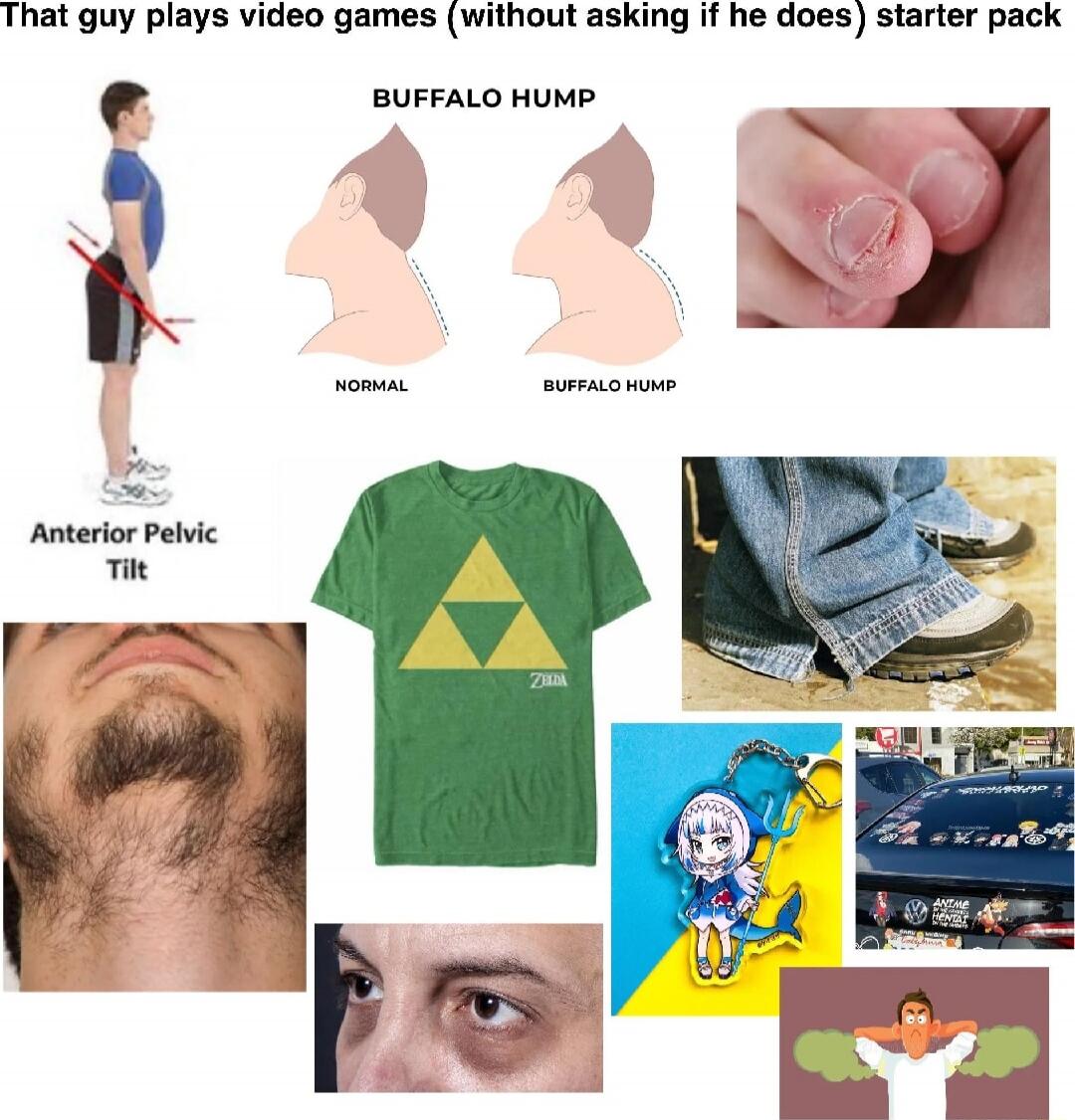 That guy plays video games (without asking if he does) starter pack
BUFFALO HUMP
NORMAL
BUFFALO HUMP
Anterior Pelvic Tilt