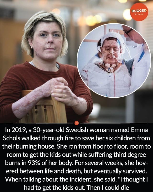 BUGGED SPACE. In 2019, a 30-year-old Swedish woman named Emma Schols walked through fire to save her six children from their burning house. She ran from floor to floor, room to room to get the kids out while suffering third degree burns in 93% of her body. For several weeks, she hovered between life and death, but eventually survived. When talking 
