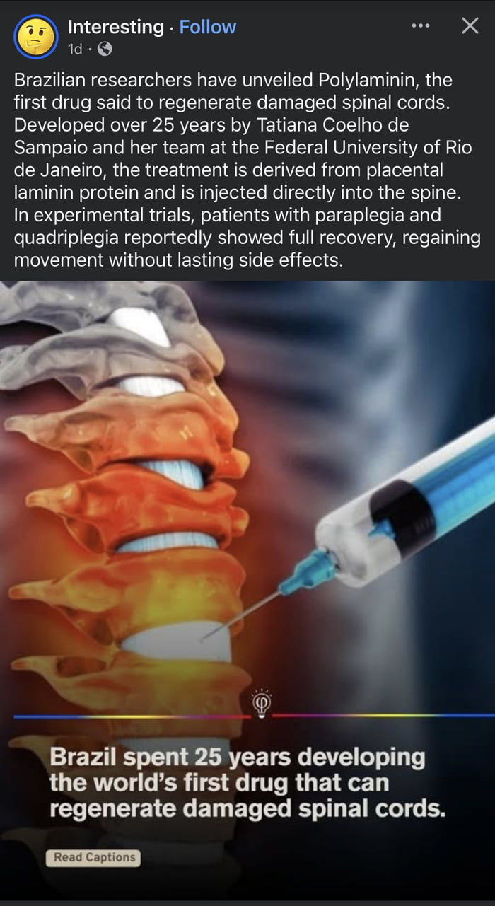 Pesquisadores brasileiros revelaram a Polilaminina, o primeiro medicamento que, segundo se diz, regenera medulas espinhais danificadas. Desenvolvido ao longo de 25 anos por Tatiana Coelho de Sampaio e sua equipe na Universidade Federal do Rio de Janeiro, o tratamento é derivado da proteína laminina placentária e é injetado diretamente na coluna ver