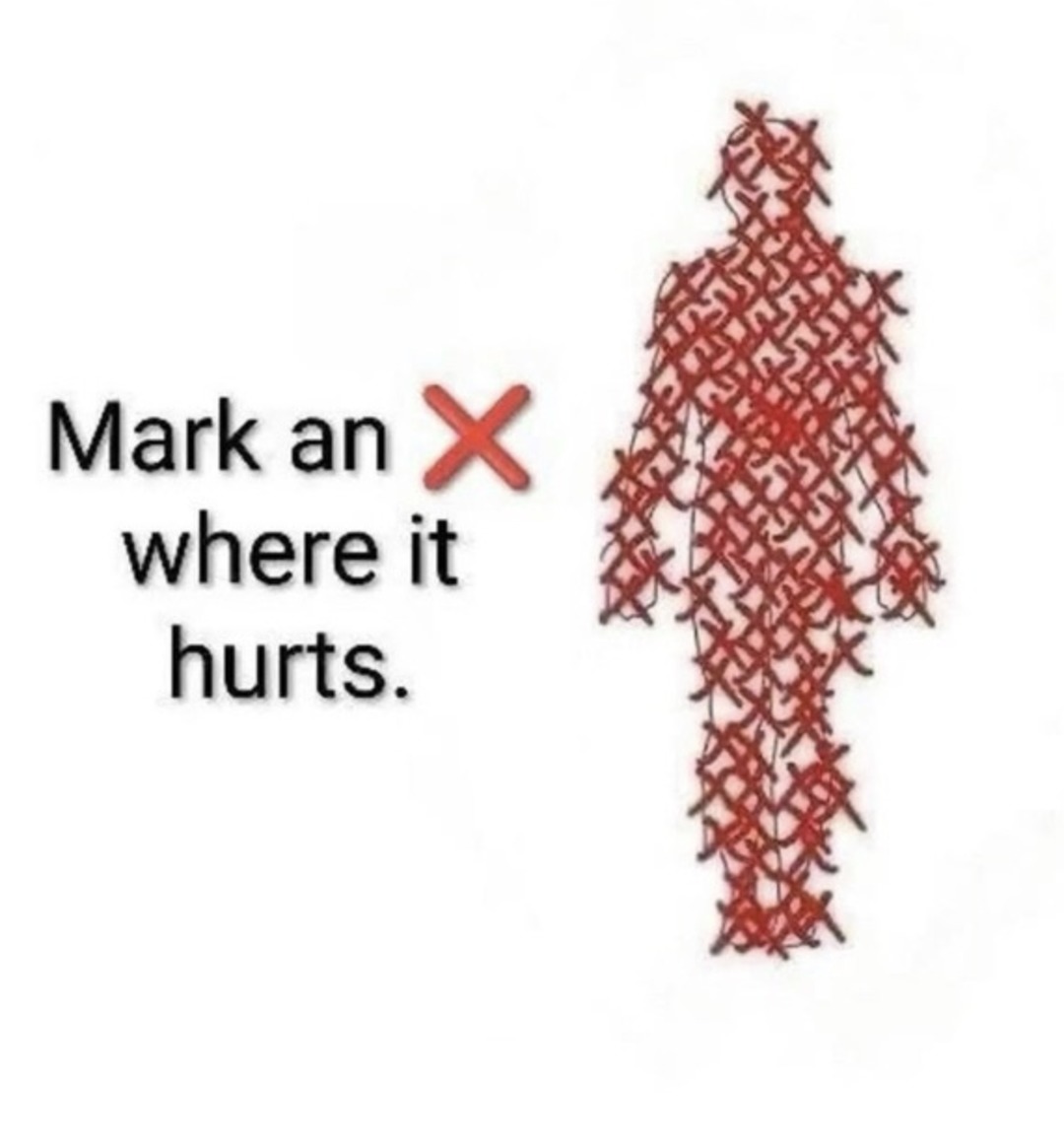 Mark an X where it hurts.