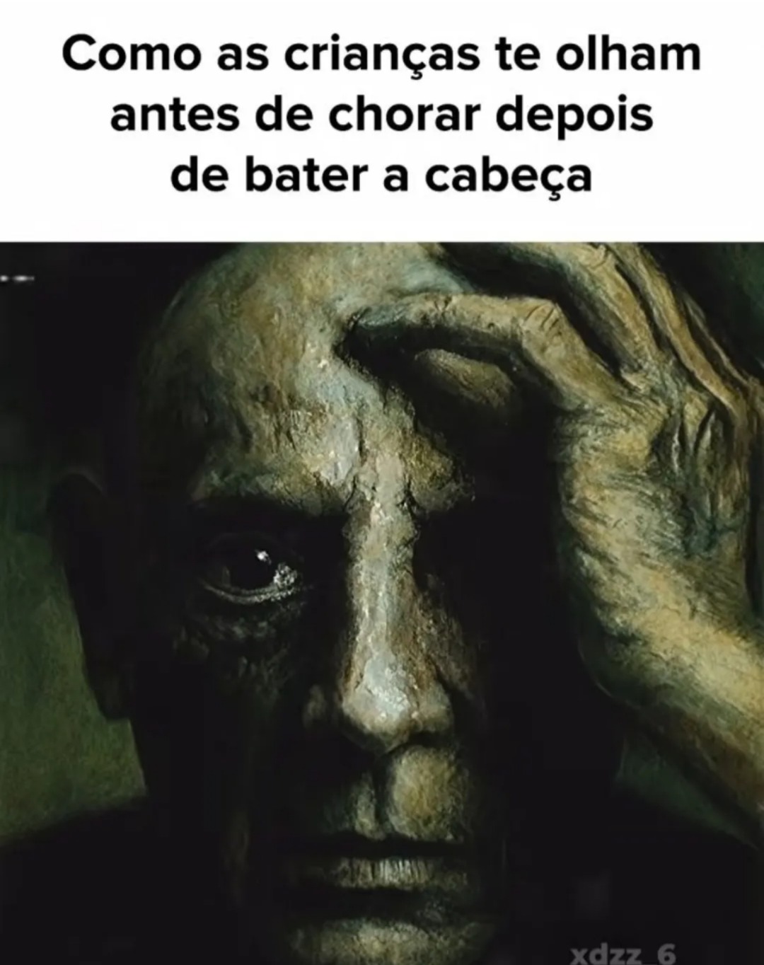 Como as crianças te olham antes de chorar depois de bater a cabeça