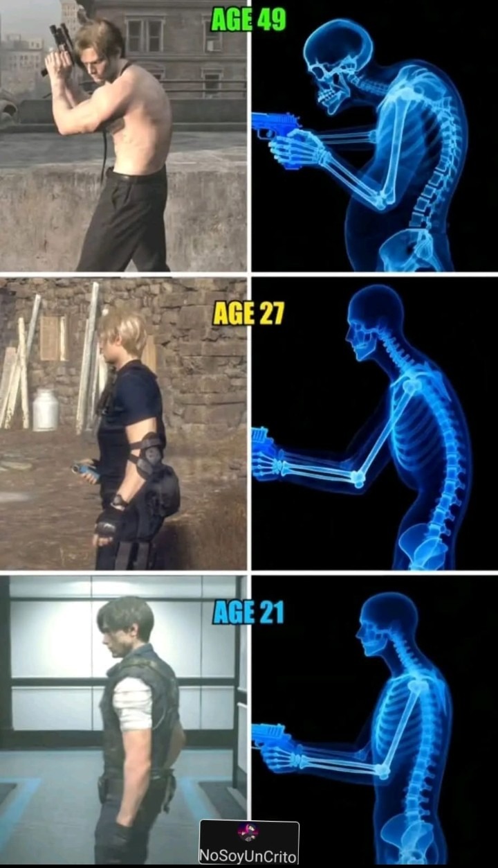 EDAD 49, EDAD 27, EDAD 21. NoSoyUnCrito. La imagen muestra la evolución de la postura de Leon S. Kennedy de Resident Evil a través de diferentes edades, comparada con radiografías de esqueletos que ilustran la curvatura de la columna vertebral.
