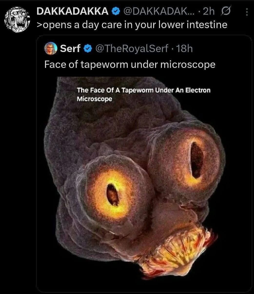 Face of tapeworm under microscope. The Face Of A Tapeworm Under An Electron Microscope. >opens a day care in your lower intestine