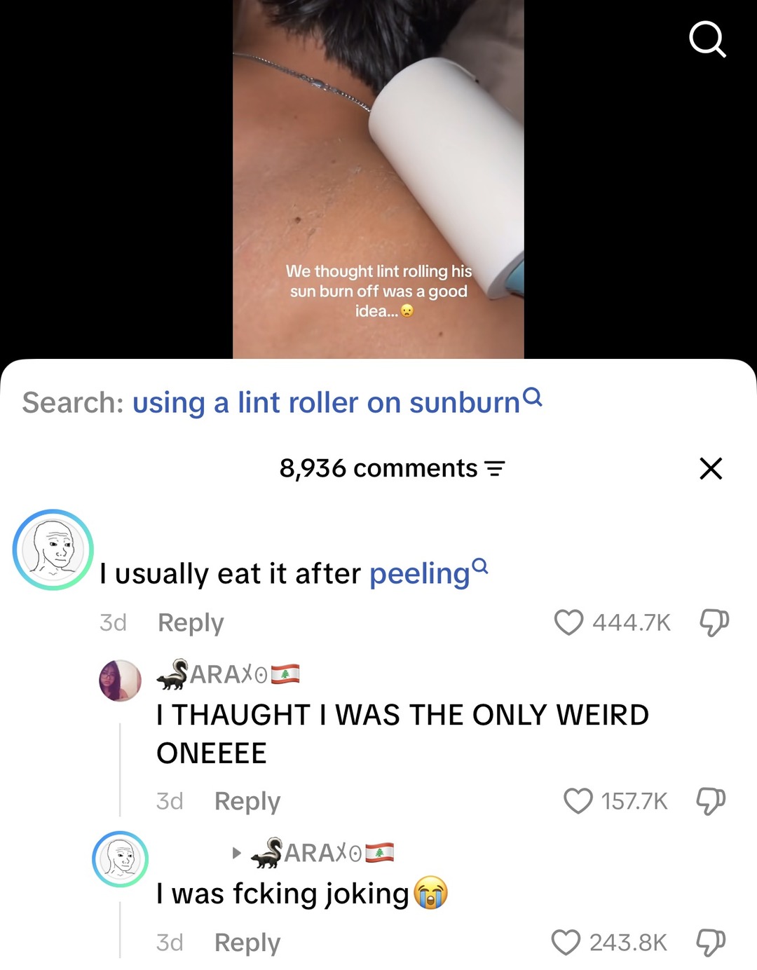 We thought lint rolling his sun burn off was a good idea... Search: using a lint roller on sunburn. I usually eat it after peeling. I THOUGHT I WAS THE ONLY WEIRD ONEEEE. I was fcking joking 😭