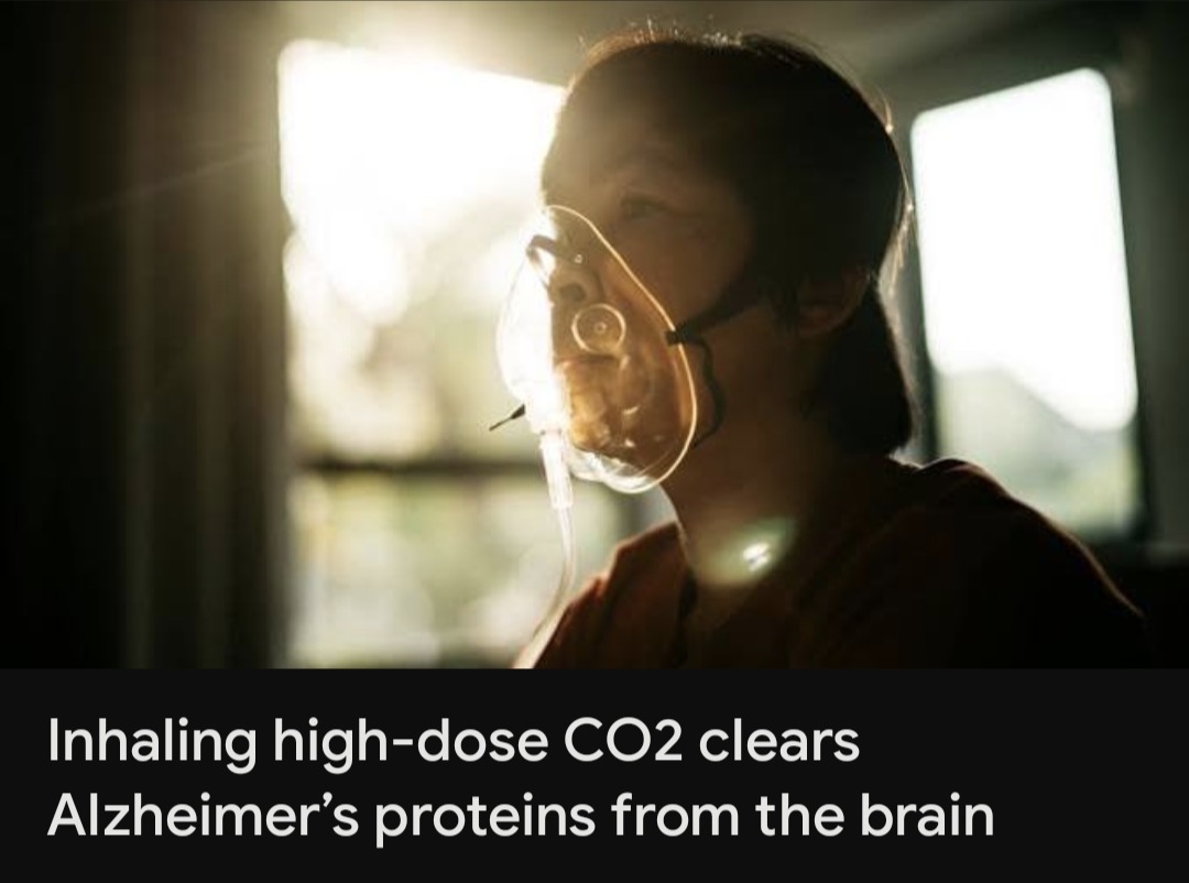 Inhaling high-dose CO2 clears Alzheimer's proteins from the brain