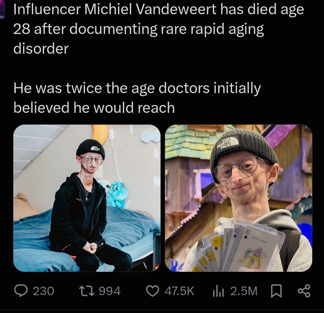 Influencer Michiel Vandeweert has died age 28 after documenting rare rapid aging disorder. He was twice the age doctors initially believed he would reach.