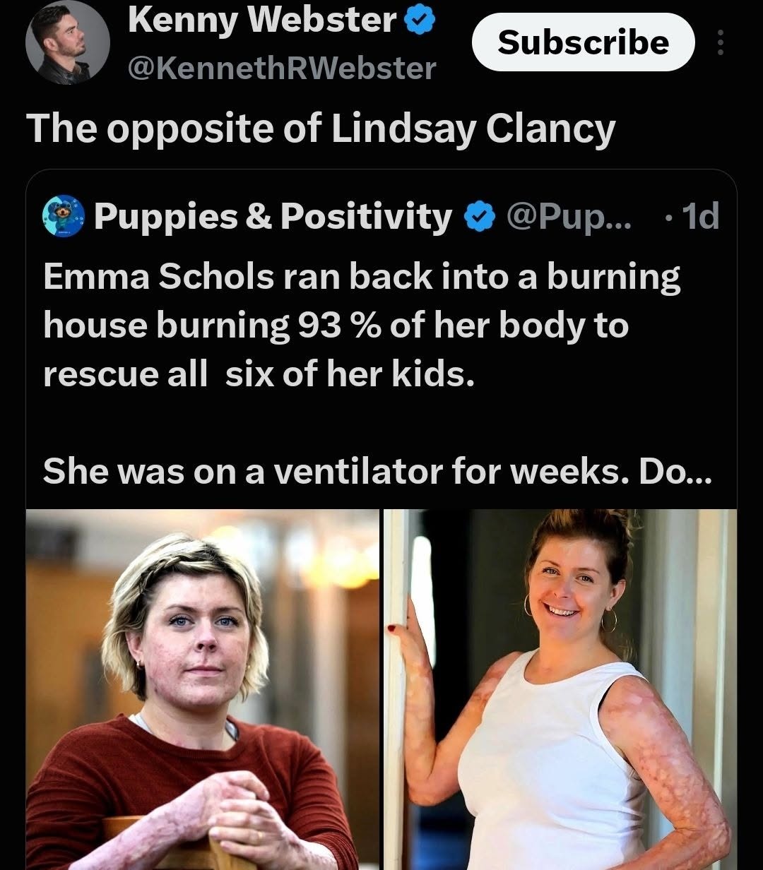 Kenny Webster @KennethRWebster Subscribe The opposite of Lindsay Clancy Puppies & Positivity @Pup... 1d Emma Schols ran back into a burning house burning 93% of her body to rescue all six of her kids. She was on a ventilator for weeks. Do...
