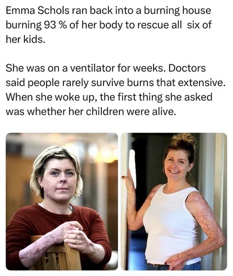 Emma Schols ran back into a burning house burning 93% of her body to rescue all six of her kids. She was on a ventilator for weeks. Doctors said people rarely survive burns that extensive. When she woke up, the first thing she asked was whether her children were alive.