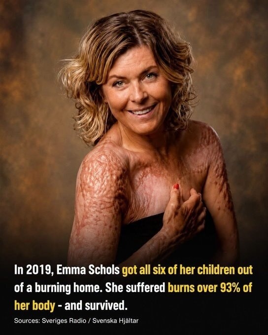 In 2019, Emma Schols got all six of her children out of a burning home. She suffered burns over 93% of her body - and survived.