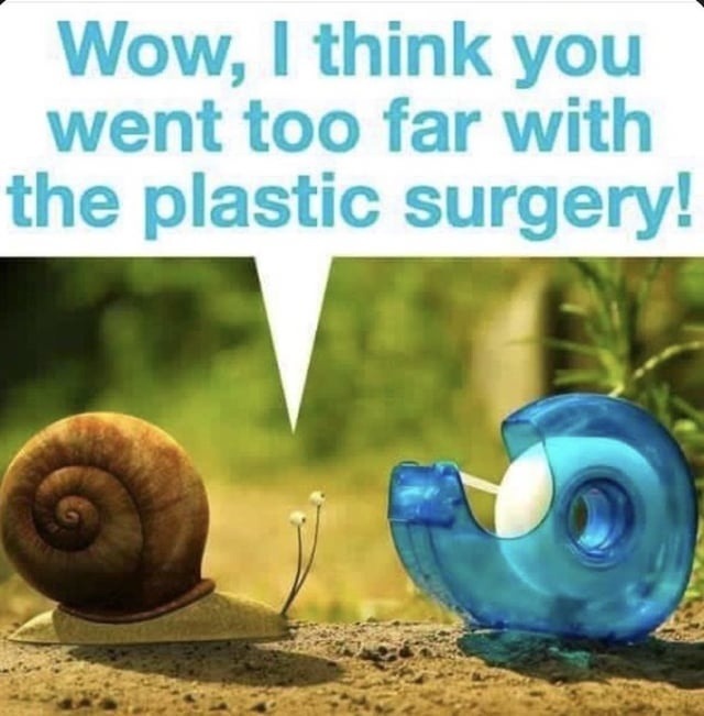 Wow, I think you went too far with the plastic surgery!